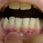 neobhodimie-preparati-i-sredstva-ot-parodontita